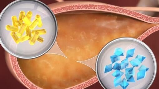 PPVD Feline UR StOx FLUTD Video